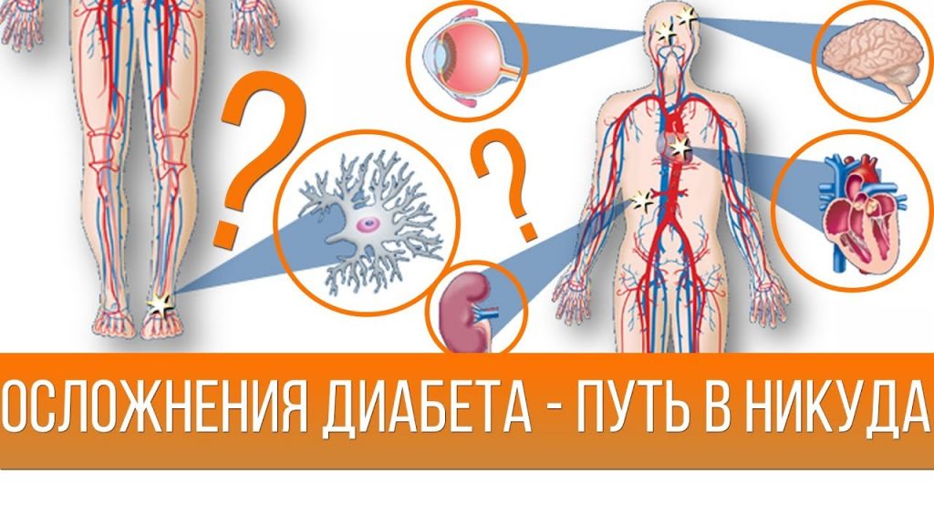 Реабилитация при сахарном диабете презентация